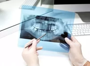 Maxilofacial